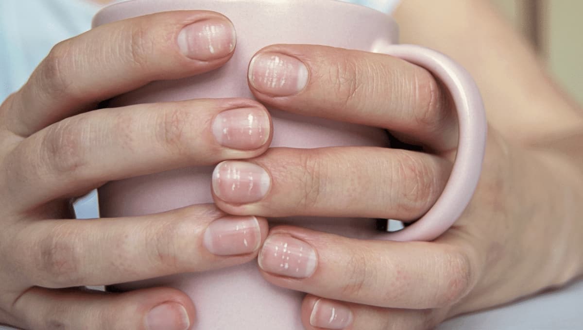 ¿Por qué salen manchas blancas en las uñas?