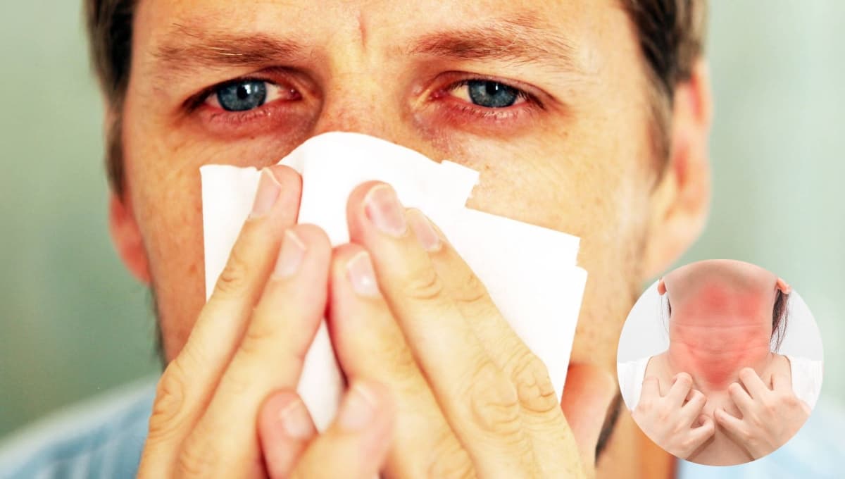 ¿Cómo saber si tengo alguna alergia? Síntomas y tipos