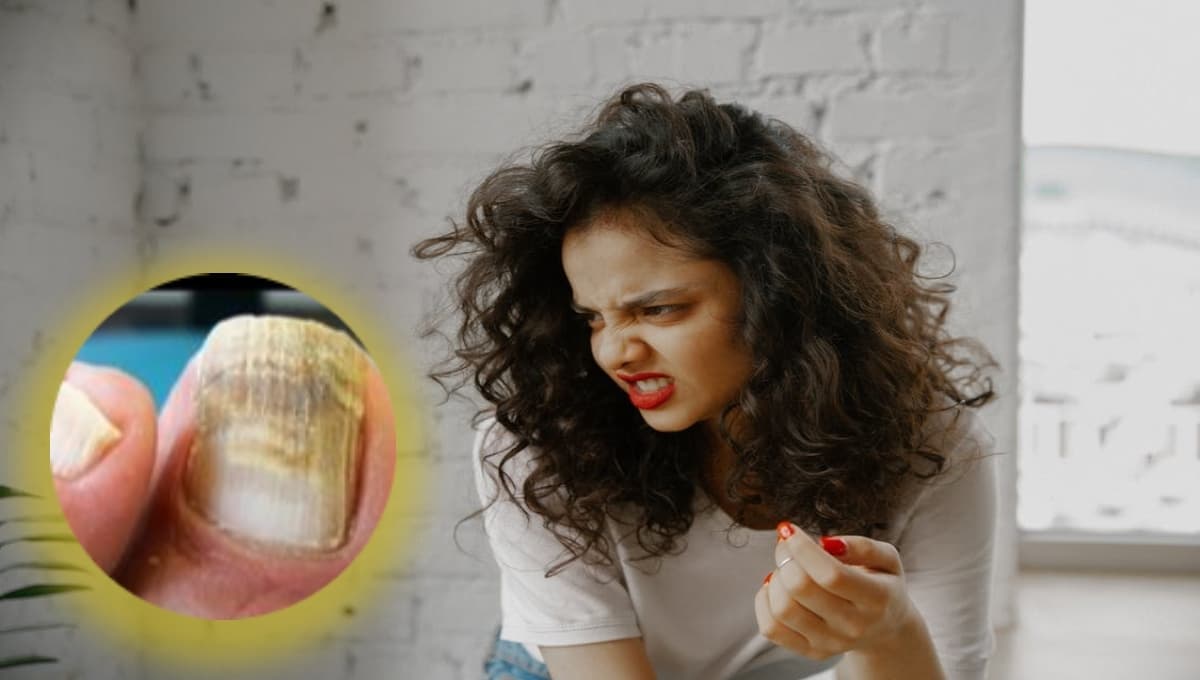 ¿Qué tipo de enfermedades se reflejan en las uñas?