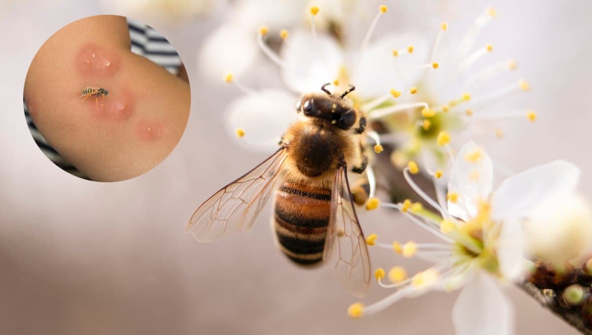 ¿Qué pasa si no me quito el aguijón de una abeja?
