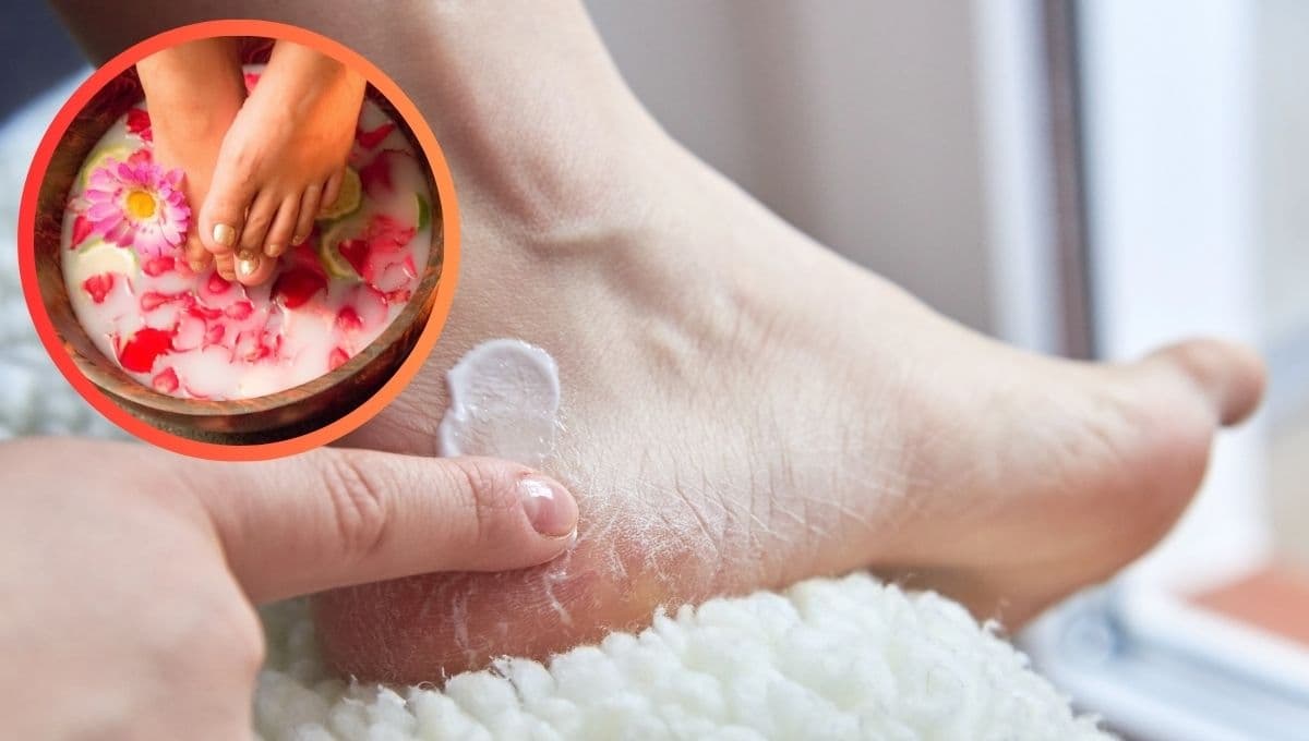 ESTA es la mascarilla casera que debes usar para eliminar los pies agrietados