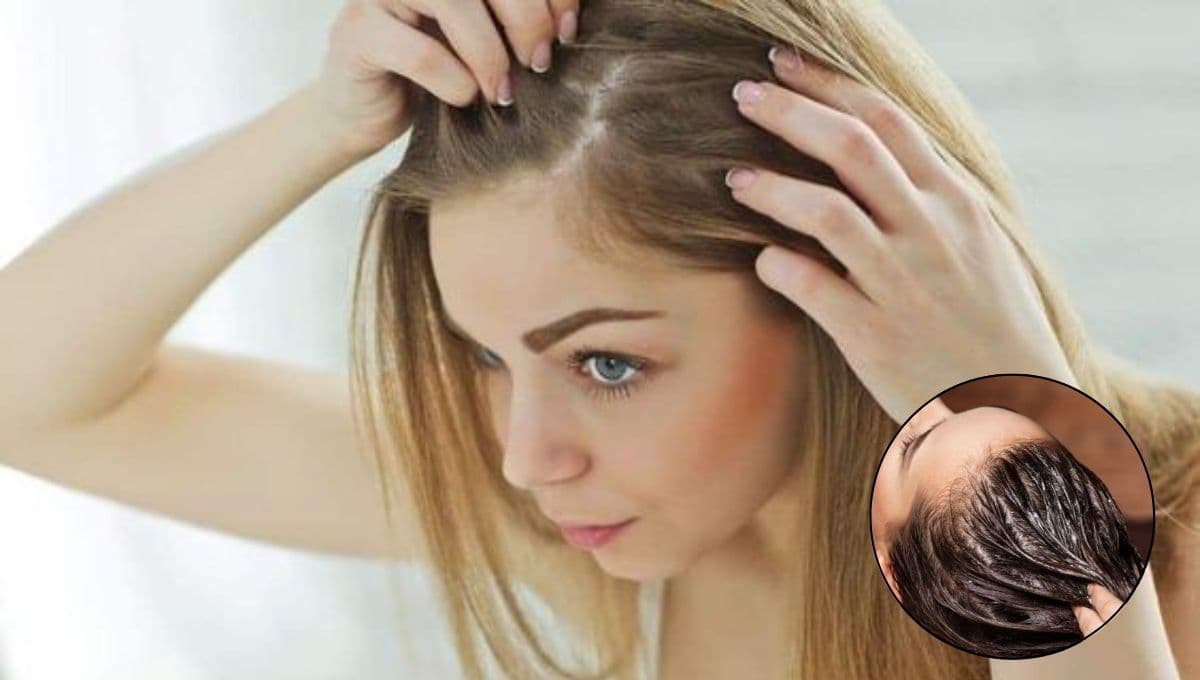 ¿Qué remedio casero es bueno para la caída del cabello?