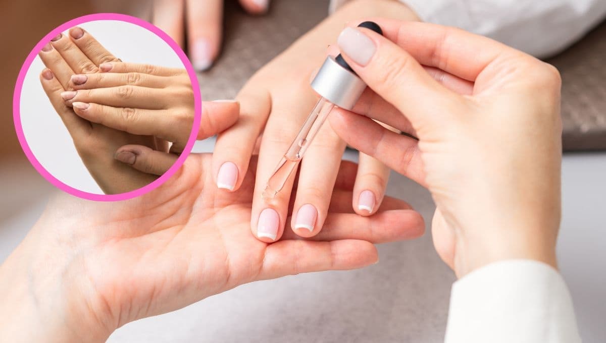 ¿Qué aceite es bueno para la resequedad de las uñas?