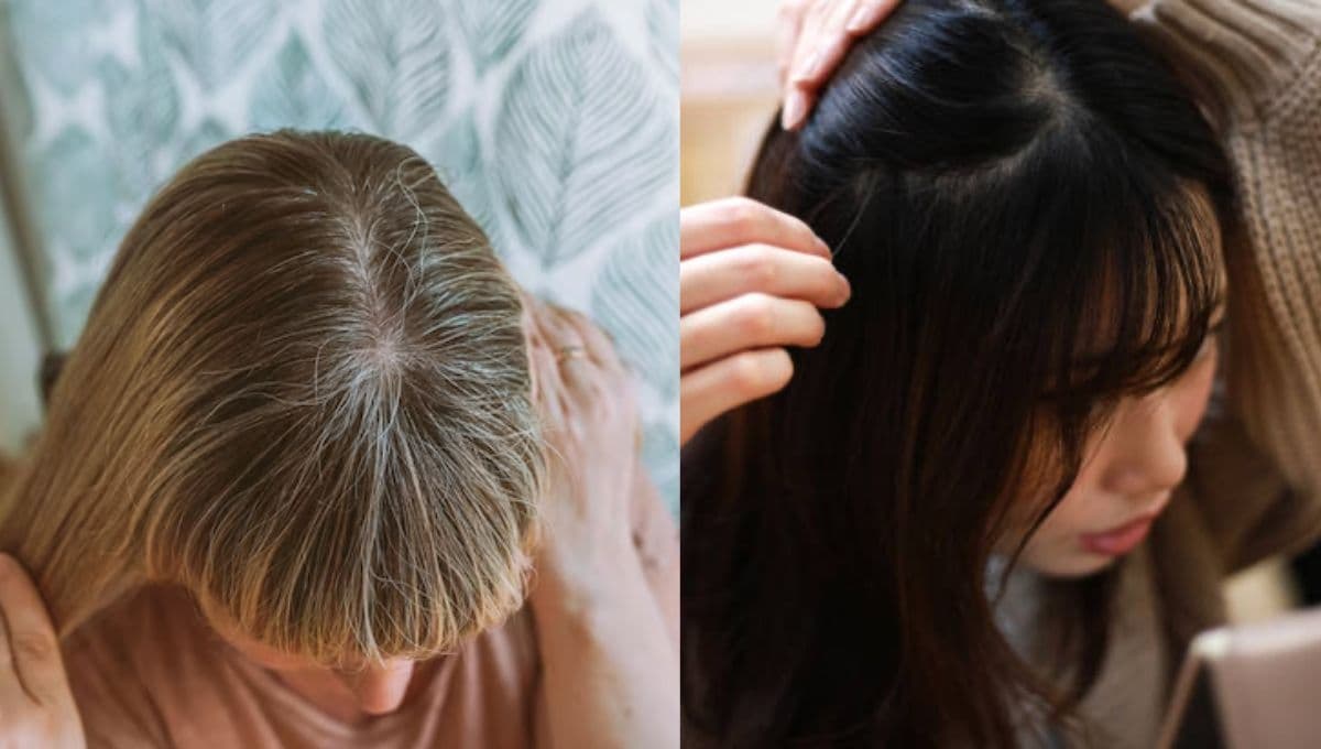 ¿Qué son las canas y qué tipos existen? Todo sobre su aparición en el cabello