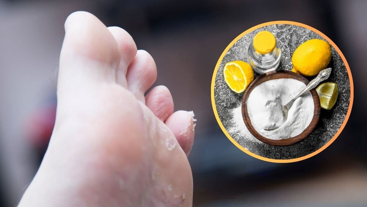 El truco con dos ingredientes para quitar los callos de los pies y dejarlos suaves