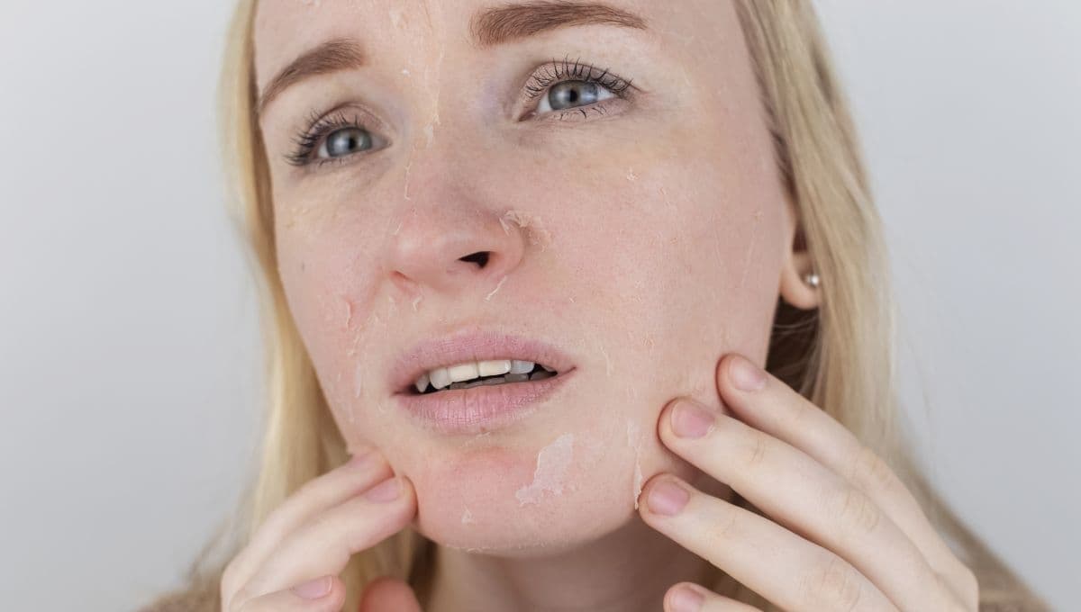 ¿Qué es bueno para la piel reseca de la cara? 5 remedios caseros perfectos para mujeres de 40 años