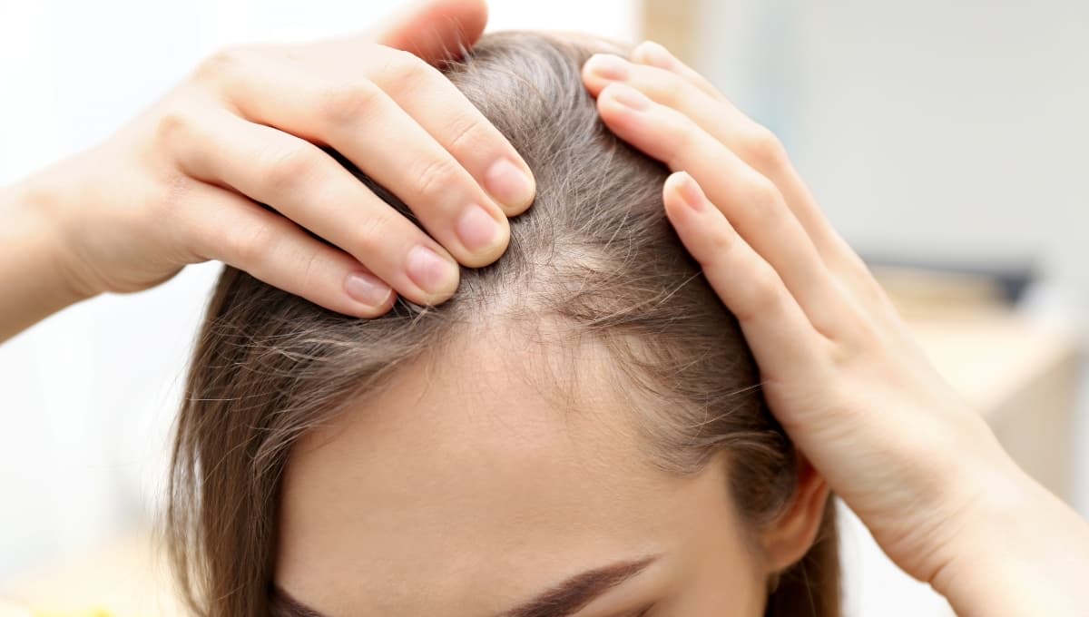 ¿Cómo prevenir la caída del cabello?