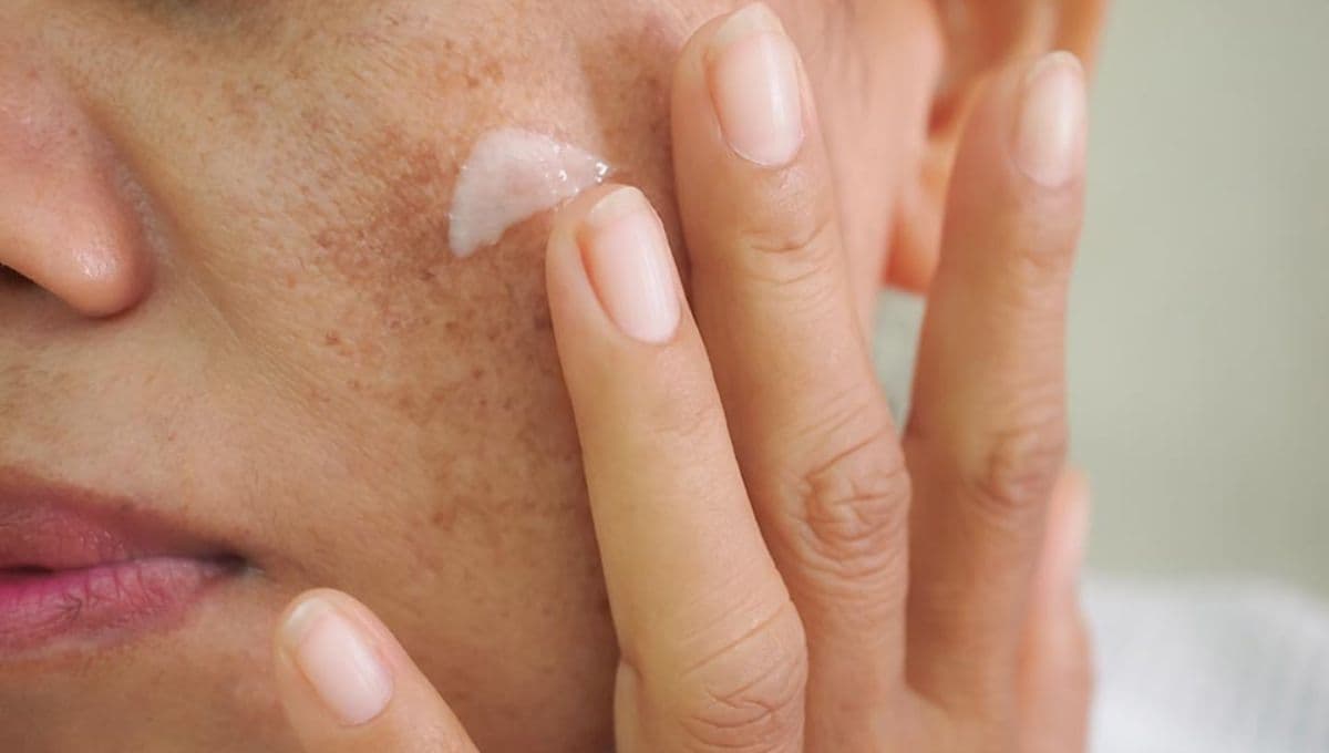 ¿Cómo se usa la crema de concha nácar? El remedio de las abuelas para aclarar la piel